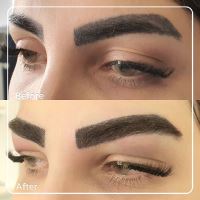 کلینیک کاشت ابرو در شیراز