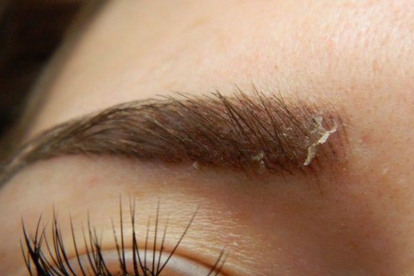 کلینیک کاشت ابرو در شیراز