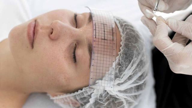 کاشت ابرو تضمینی در شیراز