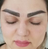 کلینیک کاشت ابرو در شیراز