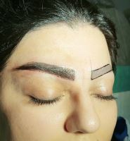کلینیک کاشت ابرو در شیراز