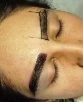 کلینیک کاشت ابرو در شیراز