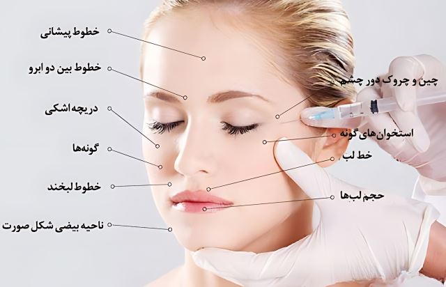 بهترین کلینیک ژل و بوتاکس در اصفهان