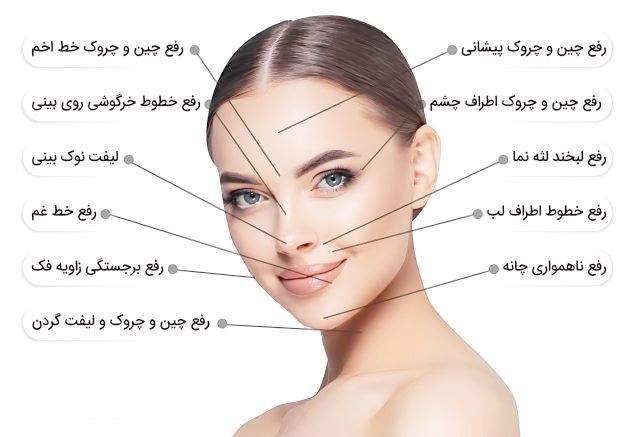 بهترین کلینیک ژل و بوتاکس در اصفهان