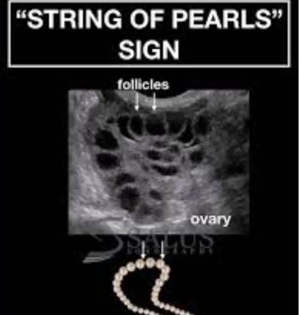 بهترین متخصص سونوگرافی خانم در اهواز 