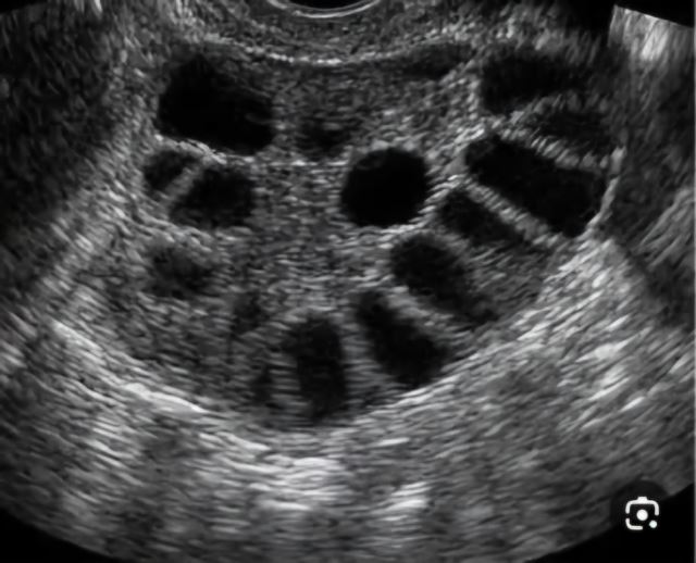 بهترین متخصص سونوگرافی خانم در اهواز 