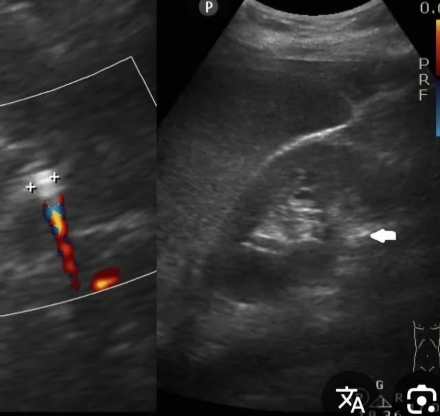 بهترین متخصص سونوگرافی خانم در اهواز 