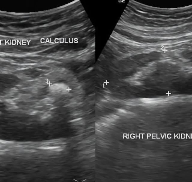بهترین متخصص سونوگرافی خانم در اهواز 