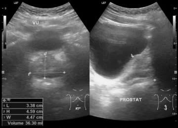بهترین متخصص سونوگرافی خانم در اهواز 