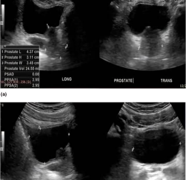 بهترین متخصص سونوگرافی خانم در اهواز 