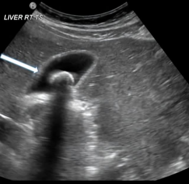 بهترین متخصص سونوگرافی خانم در اهواز 