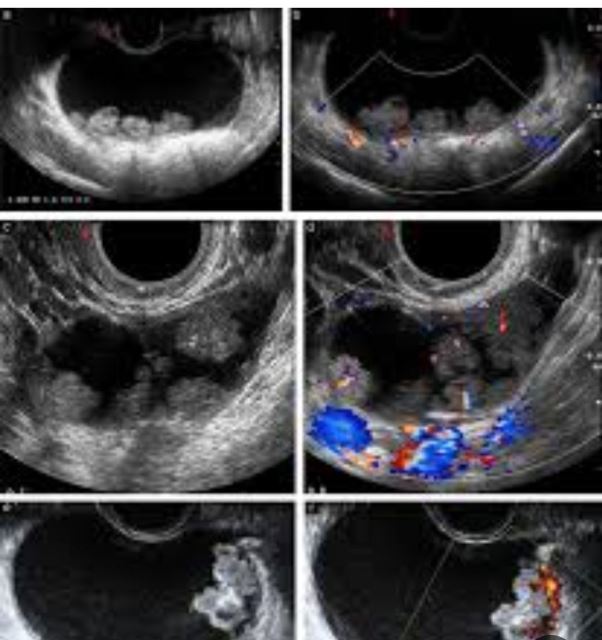 بهترین متخصص سونوگرافی خانم در اهواز 