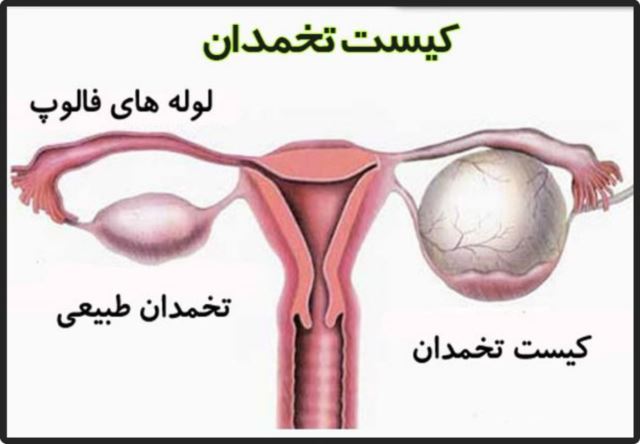 بهترین متخصص سونوگرافی خانم در اهواز 