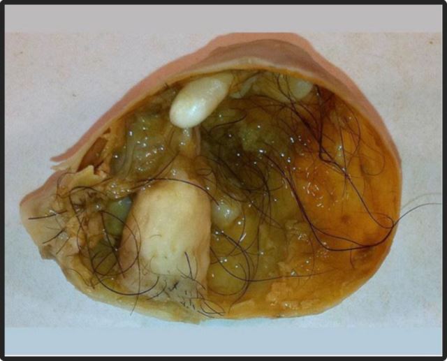 بهترین متخصص سونوگرافی خانم در اهواز 