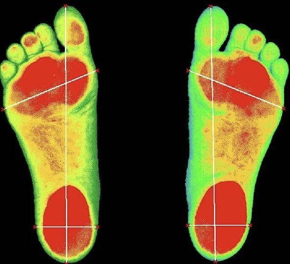 فوائد اسکن پا در اصفهان