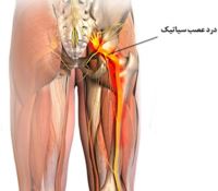 تشخیص افتراقی کف دست