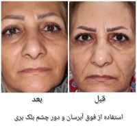 سمیه رمضانی