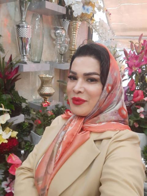 کاشت مو و ابرو تضمینی در غرب تهران 