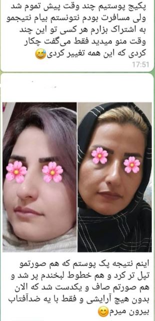 محصولات تکسو کرج