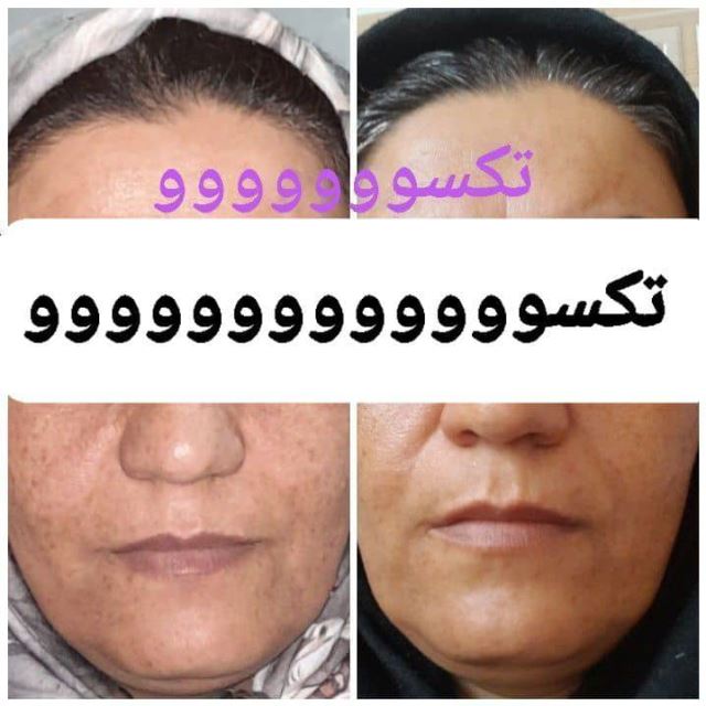 محصولات تکسو کرج