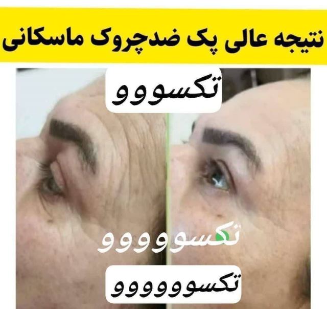 محصولات تکسو کرج