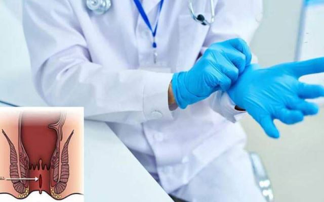 لیزر فیستول در اصفهان 