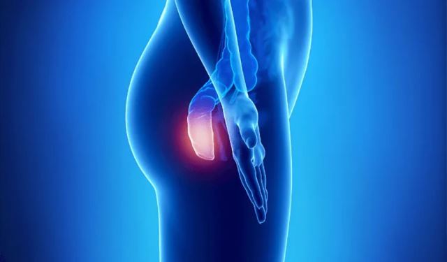 لیزر فیستول در اصفهان 