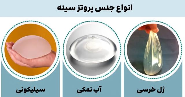 عمل لیزر سینه در اصفهان 