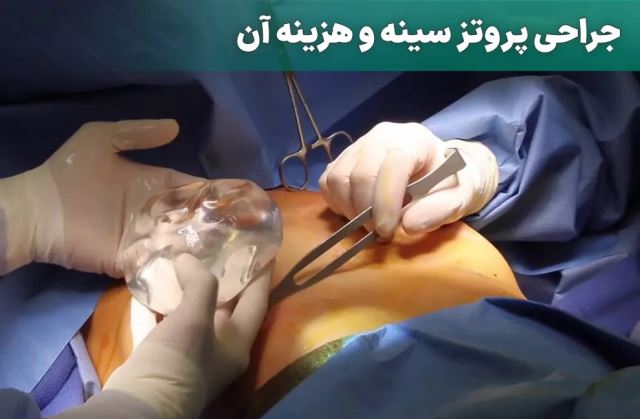 عمل لیزر سینه در اصفهان 