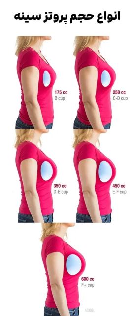 عمل لیزر سینه در اصفهان 