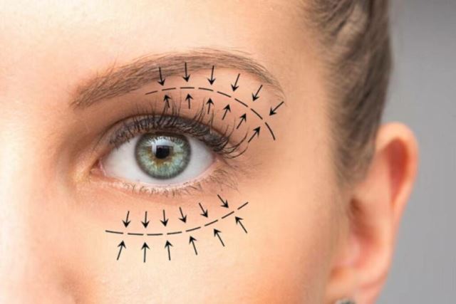 جراحی زیبایی پلک در اصفهان