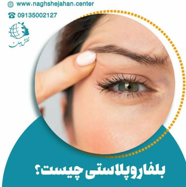 جراحی زیبایی پلک در اصفهان