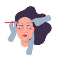 رفع غبغب در اصفهان