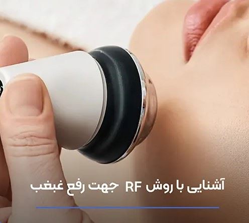 رفع غبغب در اصفهان