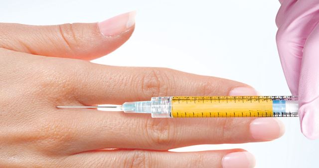 درمان افتادگی پوست صورت در اصفهان