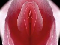 بهترین دکتر لابیاپلاستی در تهران