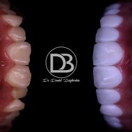 بهترین دکتر روکش دندان در اصفهان