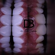 بهترین مطب دندانپزشکی در زرین شهر