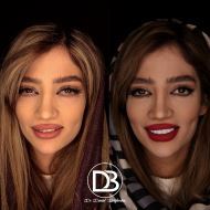 لمینت اقساطی در فولادشهر