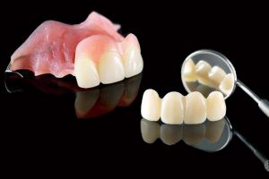 دندان تیکه ای در زرین شهر