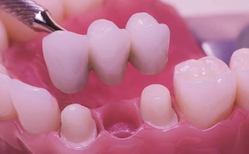 بهترین دکتر کشیدن ریشه دندان در اصفهان