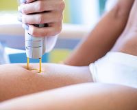 مرکز لیزر در پردیس