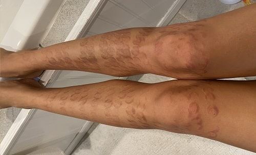 مرکز لیزر در پردیس