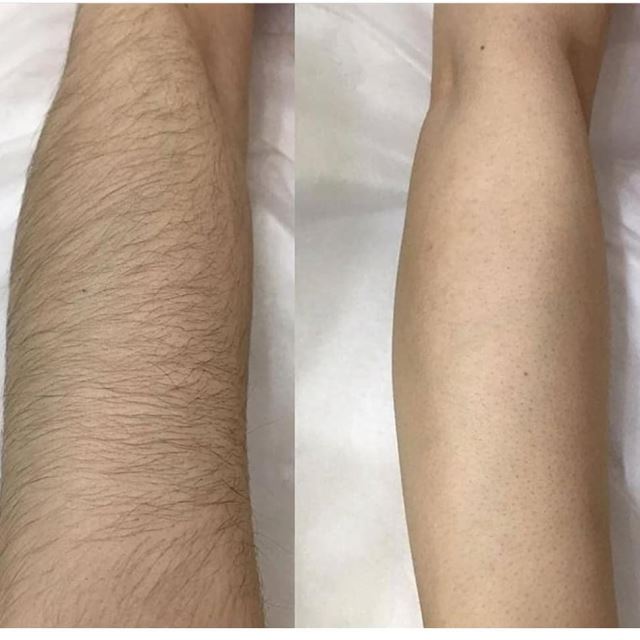 مرکز لیزر در پردیس