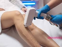 لیزر مو پردیس 09924159545 کلینیک تمنا 