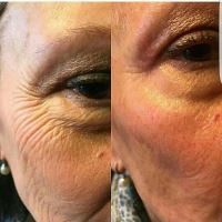 عروس سرای کابانا