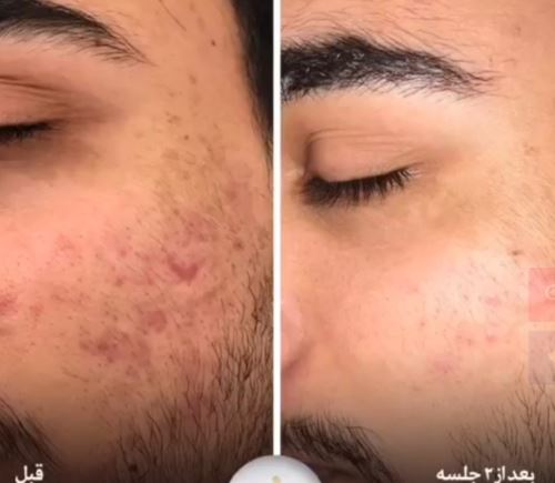 بهترین دکتر زیبایی در دزفول