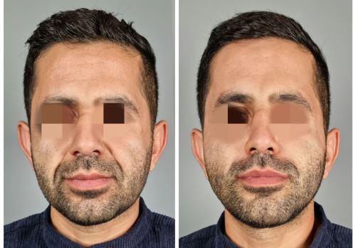 بهترین دکتر زیبایی در دزفول