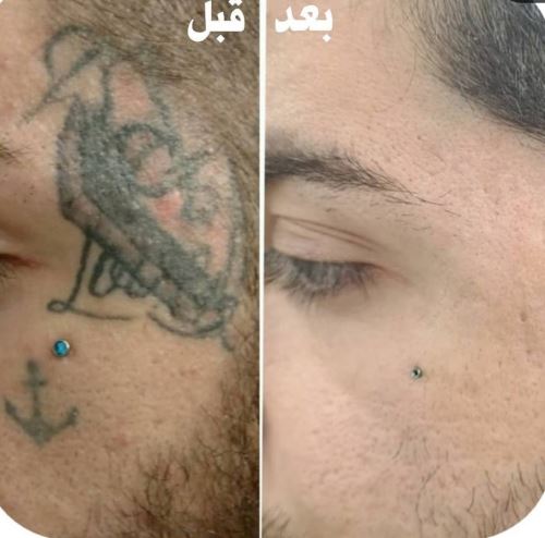 بهترین دکتر زیبایی در دزفول