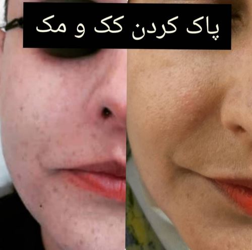 دکتر زیبایی در دزفول